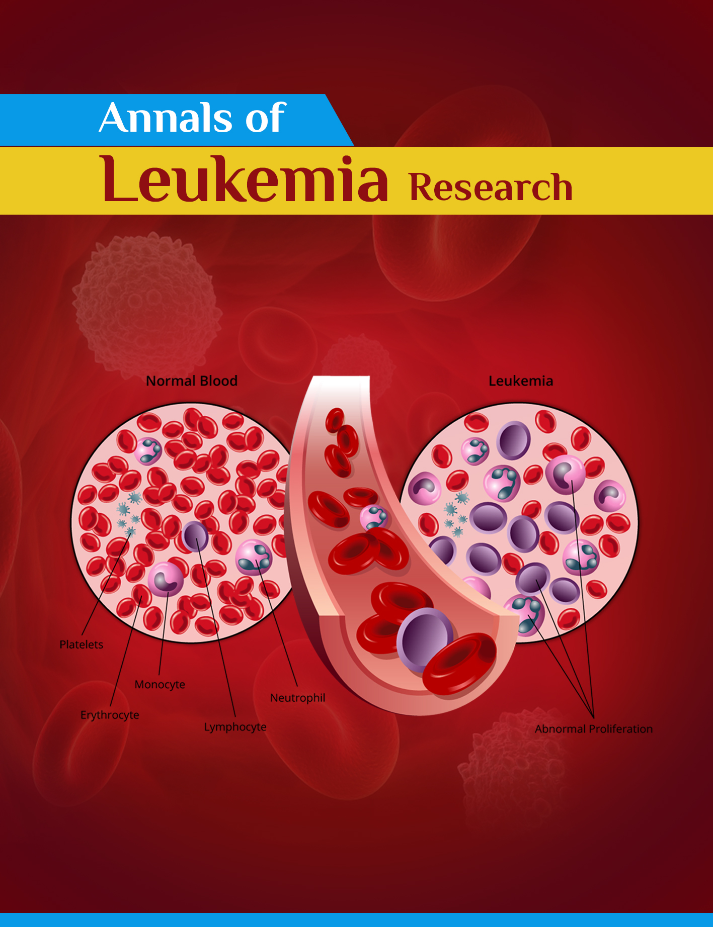 leukemia